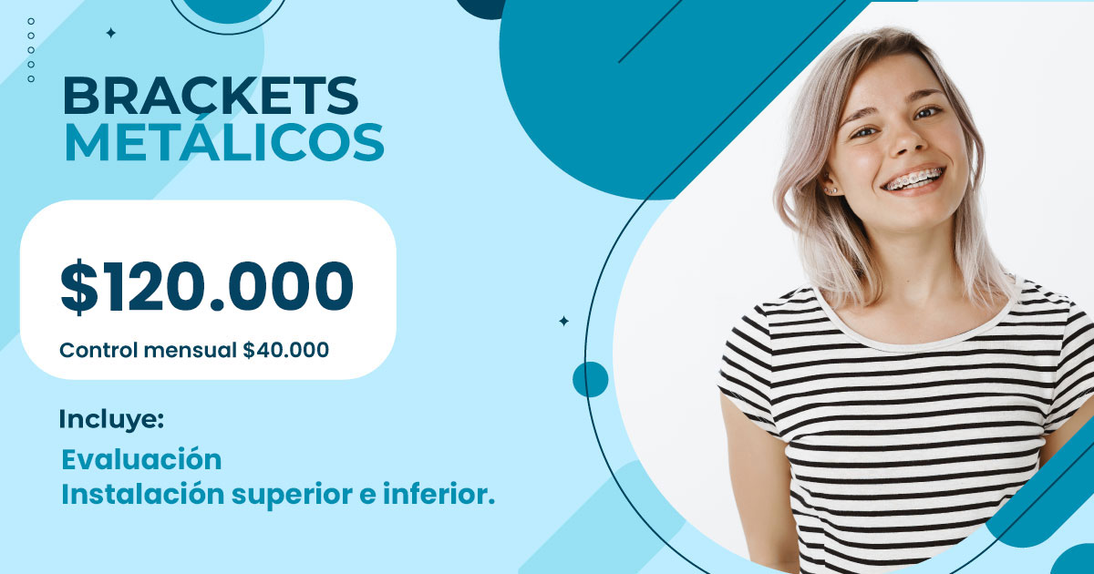 Promoción brackets metálicos