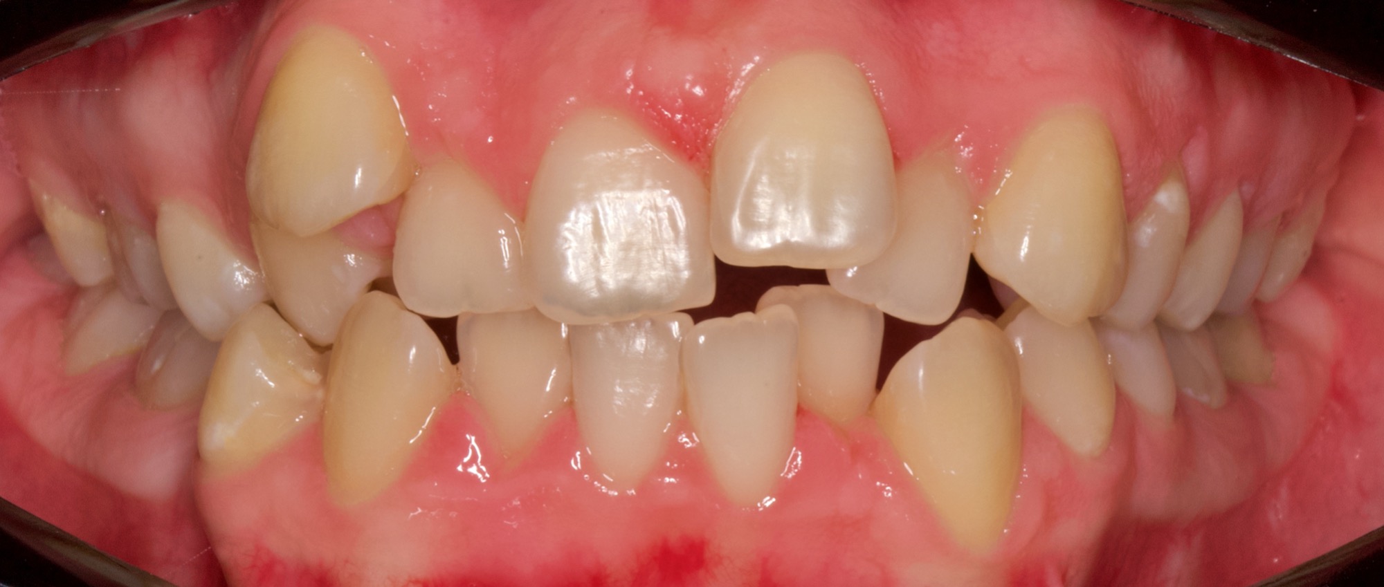 Evaluación y diagnóstico